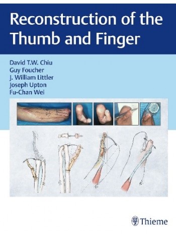 Reconstruction of the Thumb and Finger